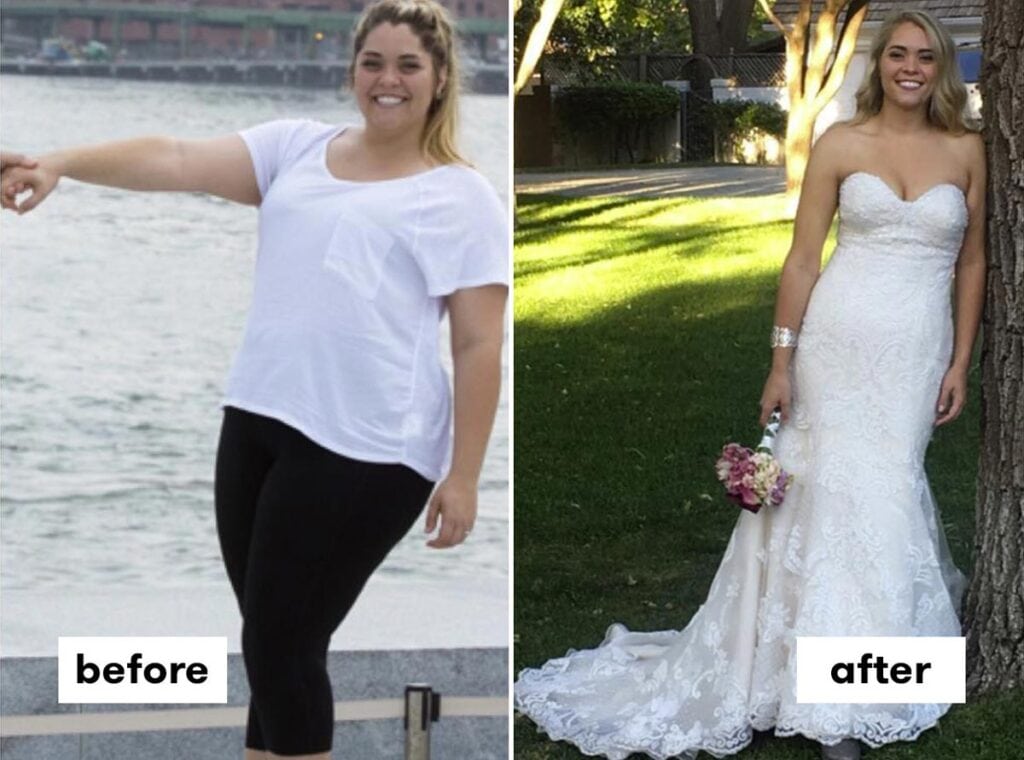Before And After Weight Loss